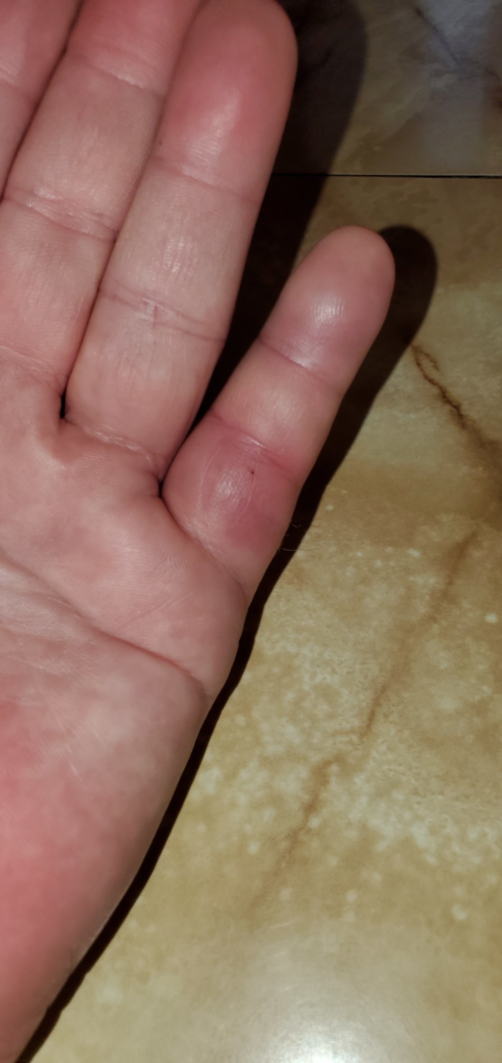 I am pretty sure my pinkie is broken, but I am also pretty sure I can live with it!