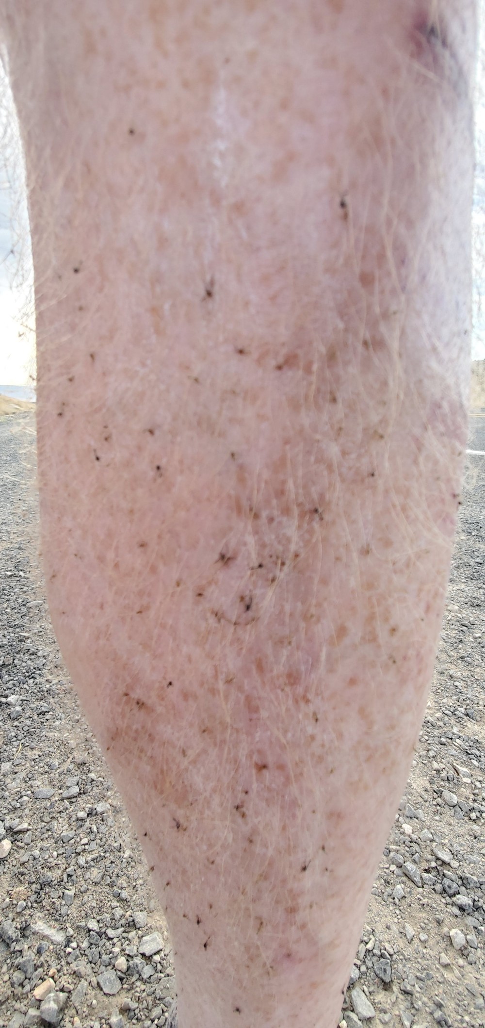 These are the bugs that adhered to the sunscreen and sweat on one leg. That's a tiny fraction of the ones that hit me. They were also in my eyebrows and my beard. Especially maddening is when they stuck to my nose, because then I could see them!